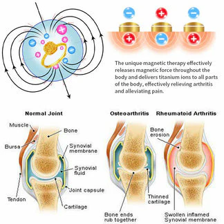 Futusly™ Lymphatische Magnettherapie Goldring