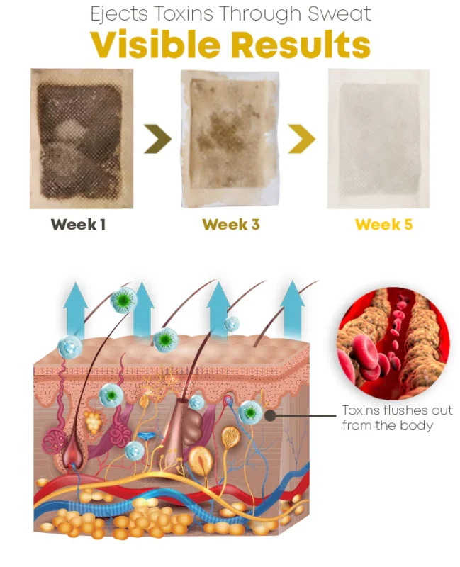 GFOUK™ Bee Venom Sculpting Lymphatic Detox Pads