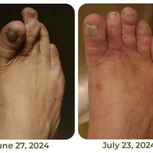 GFOUK™ CroCare Crocodile Oil Joint Therapy Balm