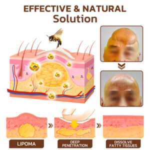 GFOUK™ Maryann Bee Venom Lymphatic Recovery Cream