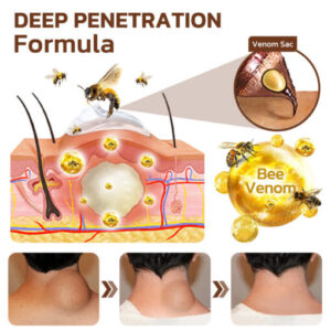 GFOUK™ Maryann Bee Venom Lymphatic Recovery Cream