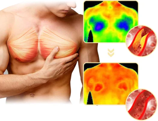GFOUK™ MenTherm Bee Venom Gynecomastia Heating Oil