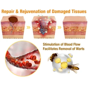 HZA™ Bee Venom Treatment Spray