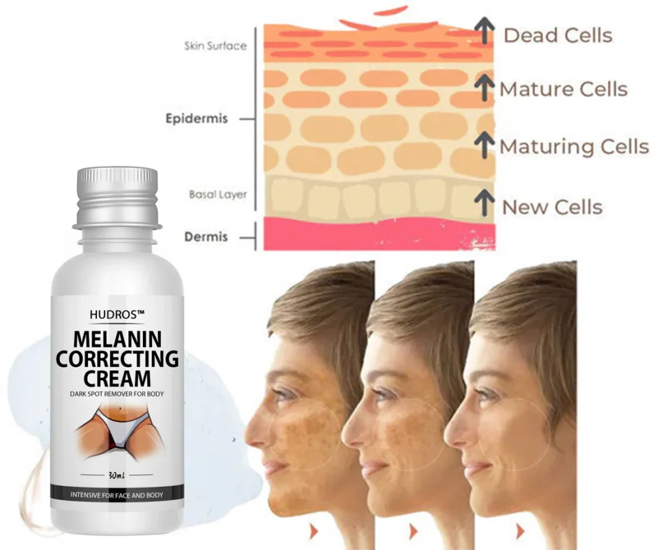 Hudros® Acanthosis Nigricans Therapy