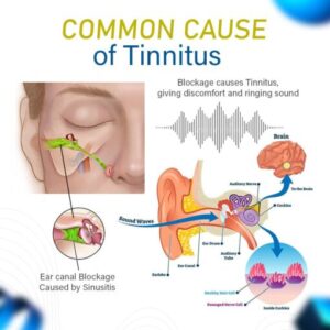 JEREMYTIS ™ Goldenseal Nasal Spray