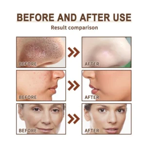 JEREMYTIS™ Natural Cleansing Black Tea Exfoliating Mask