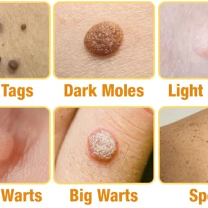 LAOZIK™ TagRecede Bee Venom Treatment Spray