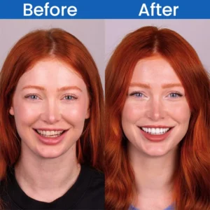 LIMETOW™ Teeth Stain Remover