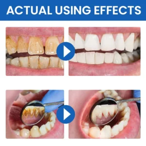 LIMETOW™ Teeth Stain Remover