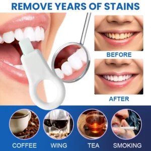 LIMETOW™ Teeth Stain Remover