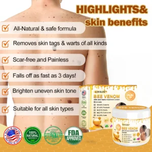 LOVILDS™ Bee Venom Mole and Wart Treatment Cream