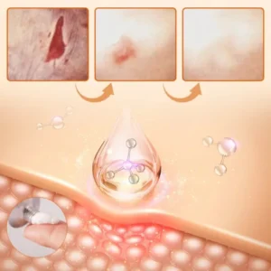 LOVILDS™Diabetic Wound Treatment Cream