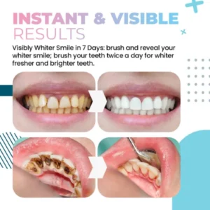 LOVILDS™Teeth Whitening Powder