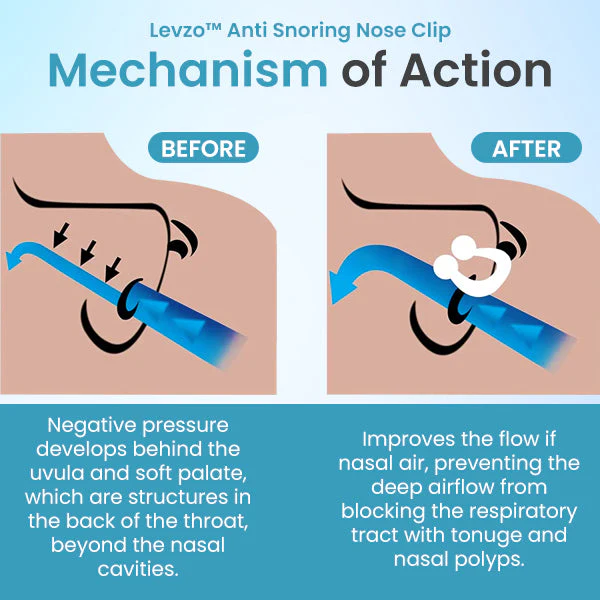 Levzo™ Anti Snoring Nose Clip