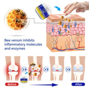 Lotmay™ Bee Venom Joint Therapy Cream