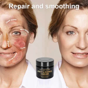 Lotmay™ Super Anti-Aging Cream