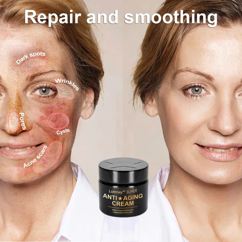 Lotmay™ Super Anti-Aging Cream