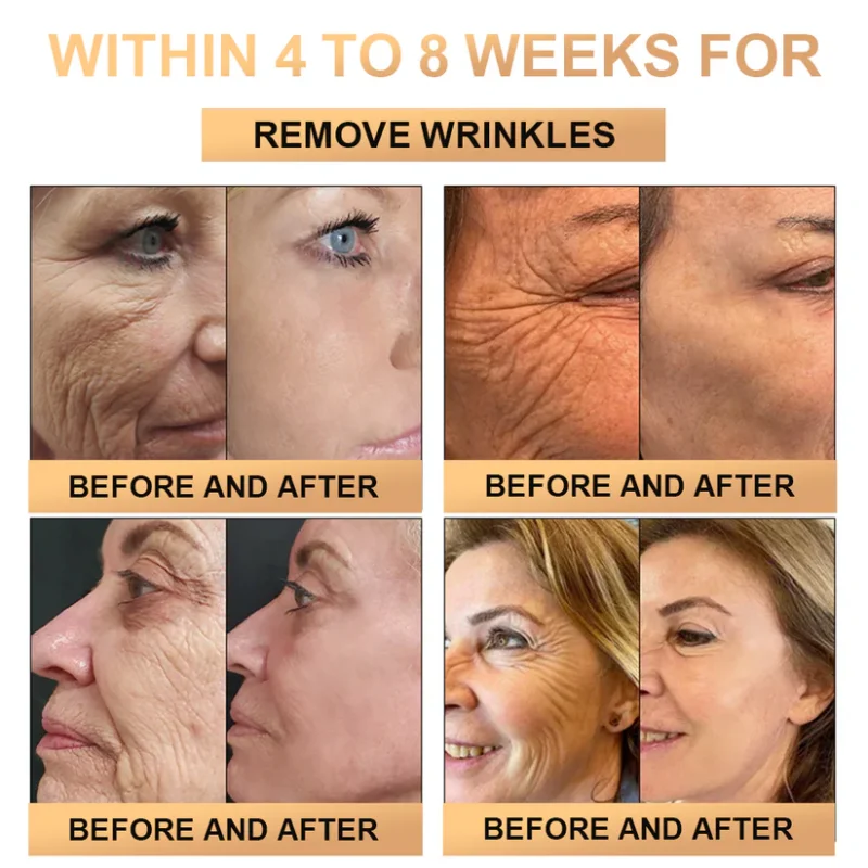 Lotmay™ Super Anti-Aging Cream