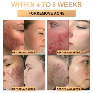 Lotmay™ Super Anti-Aging Cream