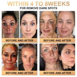 Lotmay™ Super Anti-Aging Cream