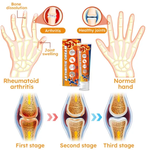 Lotmay™ Turmeric Arthritis Cream