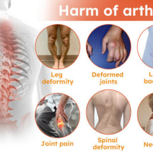 Lotmay™ Turmeric Arthritis Cream