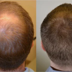 Lovilds™ Rapid Hair Growth Serum