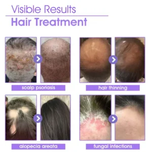Lovilds™ Rapid Hair Growth Serum
