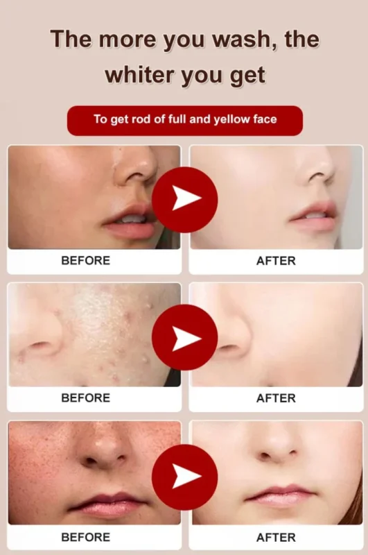 Lumiclens™ Off-Niacinamide Purifying Whitening Cleanser