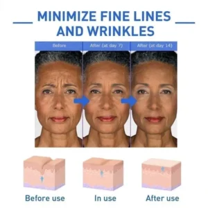 NESLEMY™botulinum Face Serum