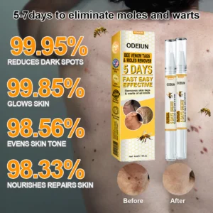ODEIUN™ Bee Venom Tags & Moles Remover