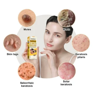 ODEIUN™ Bee Venom Tags & Moles Remover