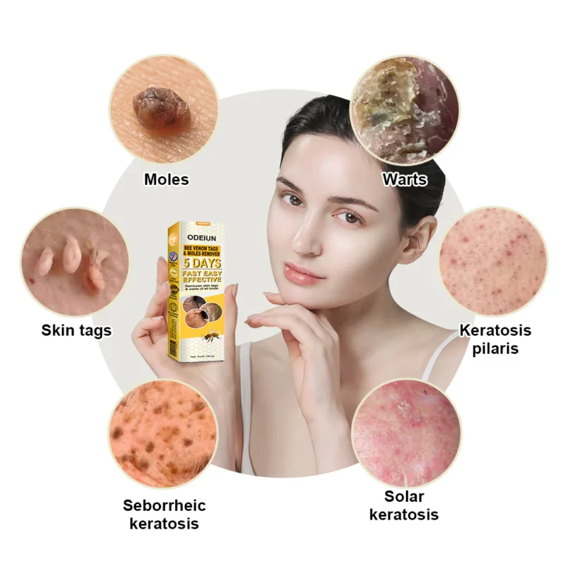 ODEIUN™ Bee Venom Tags & Moles Remover