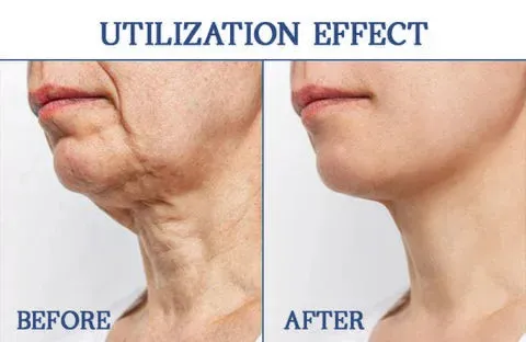 a woman's neck and neck before and after