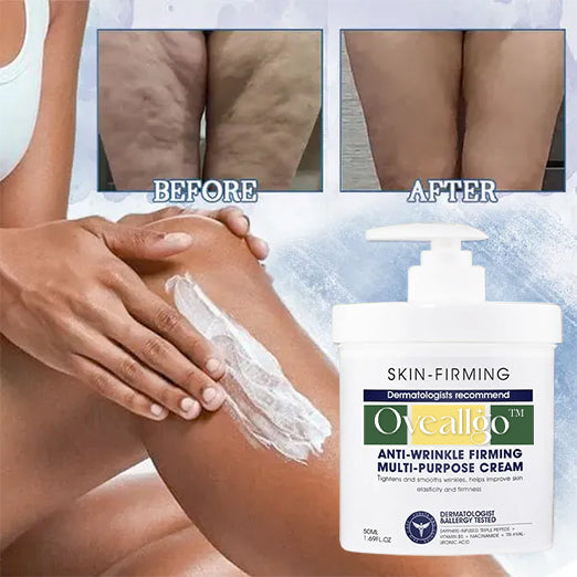 Oveallgo™ Advanced Firming & Wrinkle-Reducing Cream