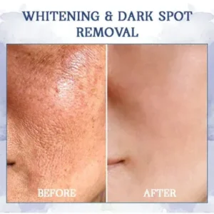 Oveallgo™ Advanced Firming & Wrinkle-Reducing Cream