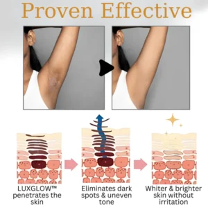 Oveallgo™ Body Whitening Cream