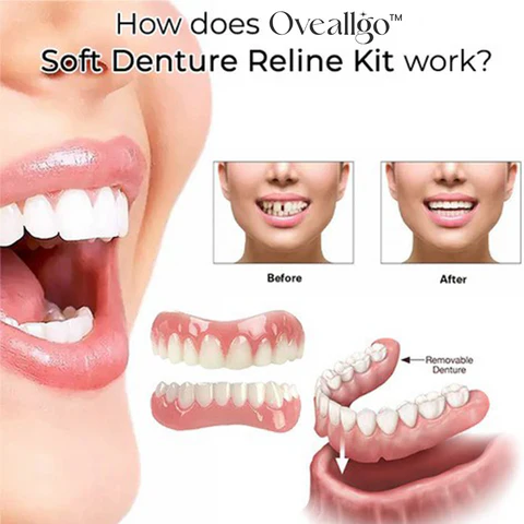Oveallgo™ Comfort Soft Denture Reline Kit
