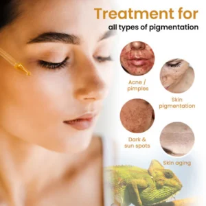 Oveallgo™ Dark Spot and Skin Tone Corrector