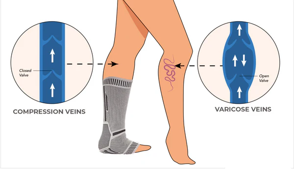 Oveallgo™ Self-Heating Tech Anti Edema Compression Socks