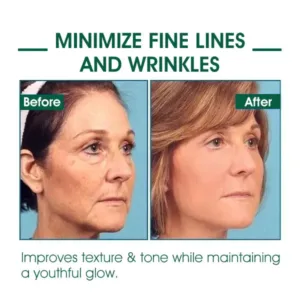 Oveallgo™ SkinFirming Rejuvenating Serum