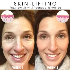 Oveallgo™ SkinFirming Rejuvenating Serum