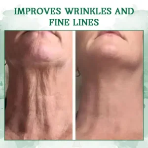 Oveallgo™ SkinFirming Rejuvenating Serum