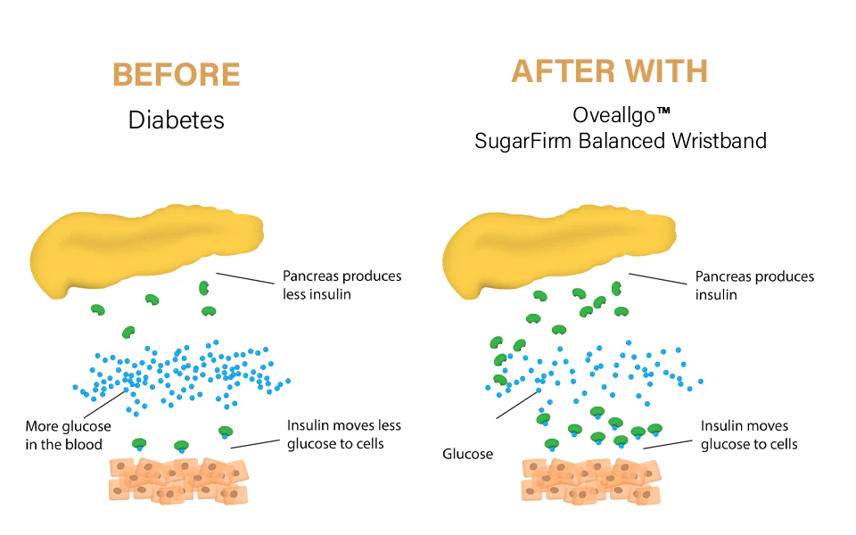 Oveallgo™ SugarFirm Balance Wristband
