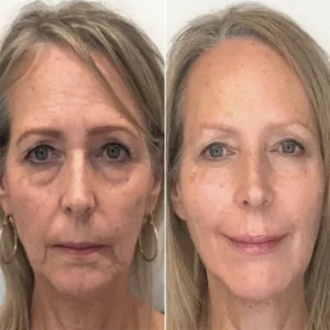 PEPTIDE Wrinkle Reducing Cream