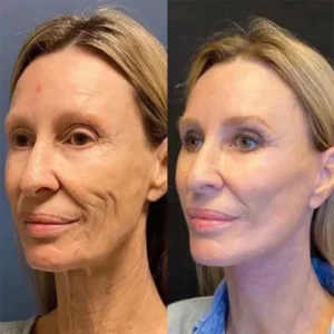 PEPTIDE Wrinkle Reducing Cream