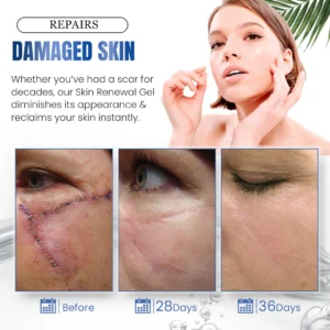 Seurico™ Advanced Silicone Skin Renewal Gel