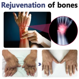 Seurico™ Bee Venom Joint and Bone Therapy Advanced Cream