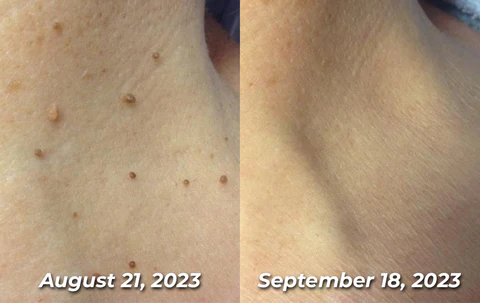 Seurico™ TagRecede Bee Venom Treatment Spray