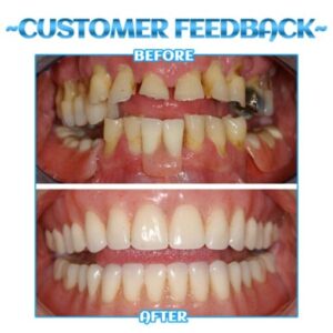 Tiworld™ FreshTooth360° Mouthwash